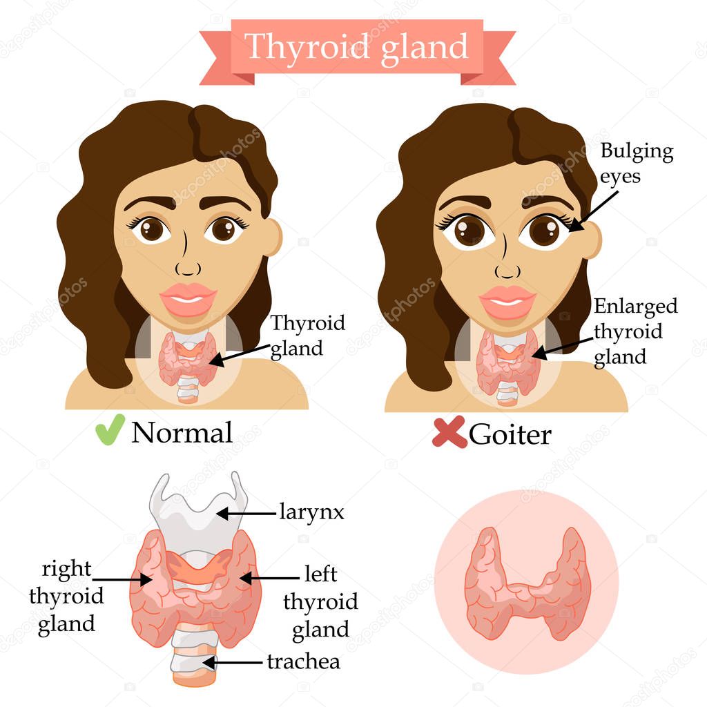 Thyroid gland. Medical concept. Anatomy of people. Vector illustration. Healthcare banner with woman. 
