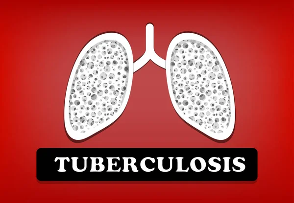 Tuberculose, longkanker in vector design — Stockvector