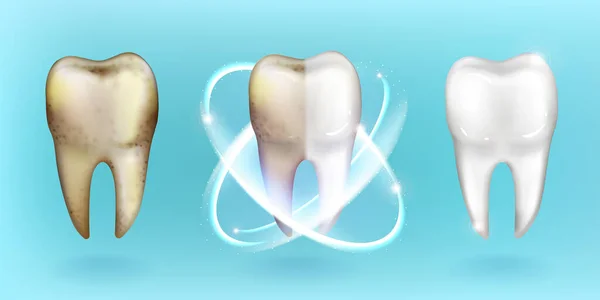 Dents propres et sales, blanchissant ou nettoyant les dents — Image vectorielle