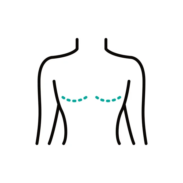 Mastectomía Icono Línea Ilustración Simple Vector — Vector de stock
