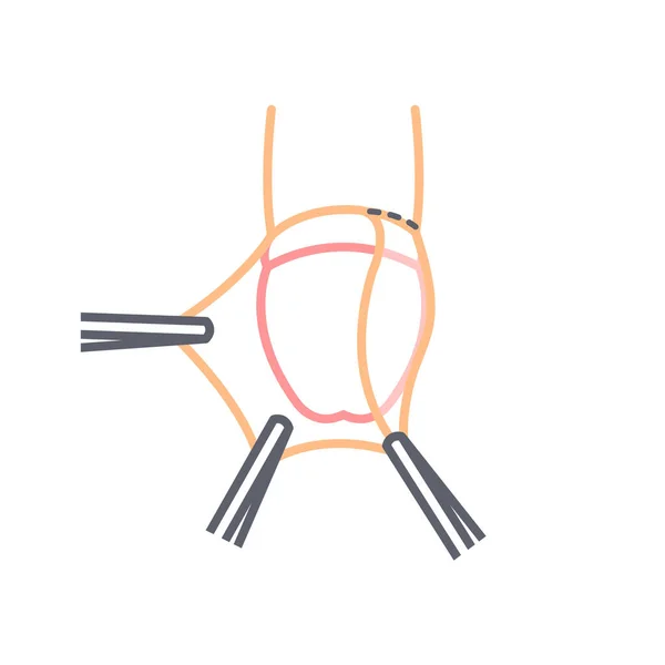 Icona Della Linea Circoncisione Semplice Illustrazione Vettoriale — Vettoriale Stock