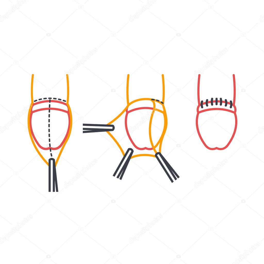 circumcision line icon, vector simple illustration