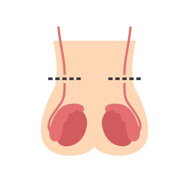 Vazektomi yassı simgesi, vektör basit illüstrasyon