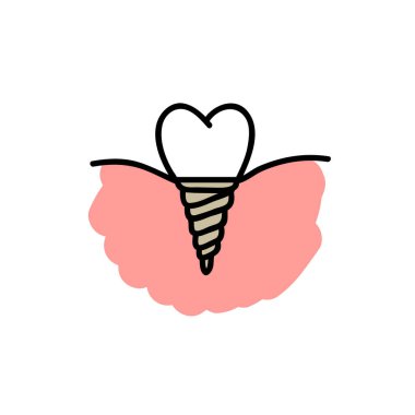 Diş implantı karalama simgesi, vektör renk çizimi