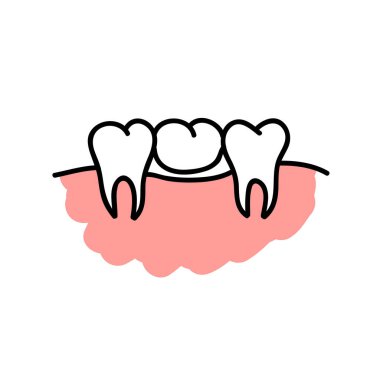 diş köprüsü karalama simgesi, vektör rengi çizimi