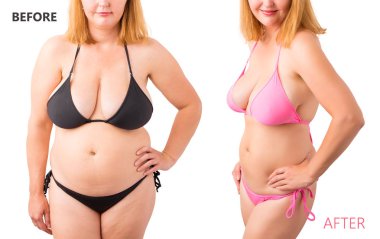 Önce ve sonra kilo kaybı bikini poz içinde kadın