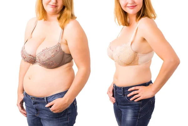 Mujer antes y después de la pérdida de peso — Foto de Stock