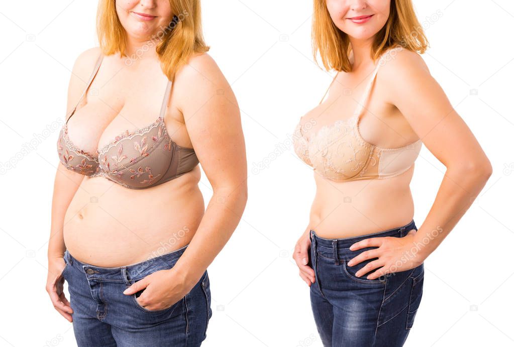 Woman before and after weight loss