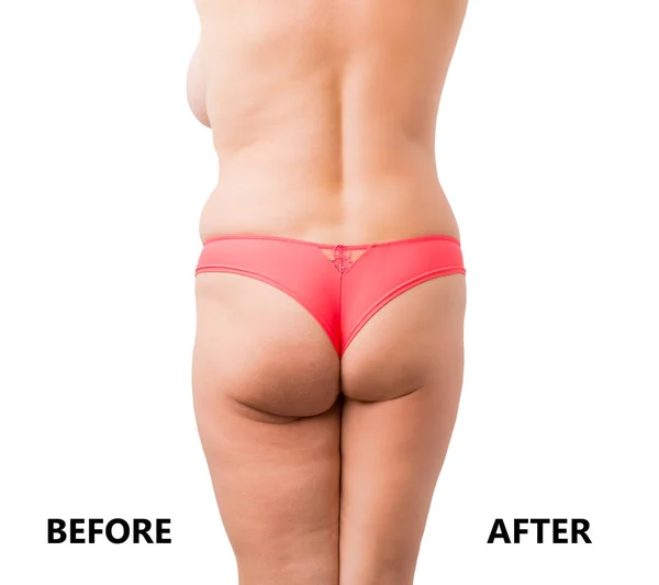 Before and after weight loss body comparison — Stock Photo, Image