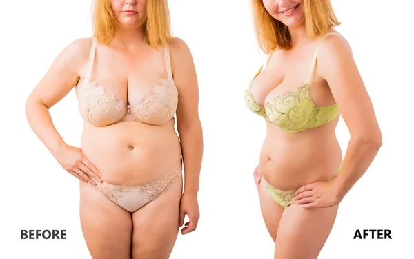 Mulher posando em roupa interior antes e depois da perda de peso — Fotografia de Stock