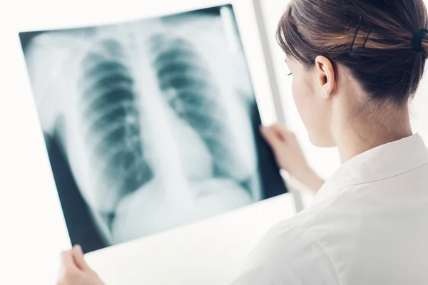 Médico examinando la radiografía de un paciente — Foto de Stock