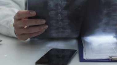 Profesyonel kadın doktor hastanın röntgenini kontrol ediyor.