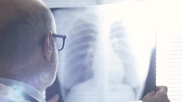 Doktor kontroluje pacientův rentgen hrudního koše — Stock video