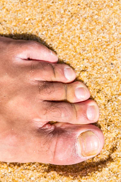 Moche Ongles D Orteils Images Libres De Droit Photos De Moche Ongles D Orteils Depositphotos