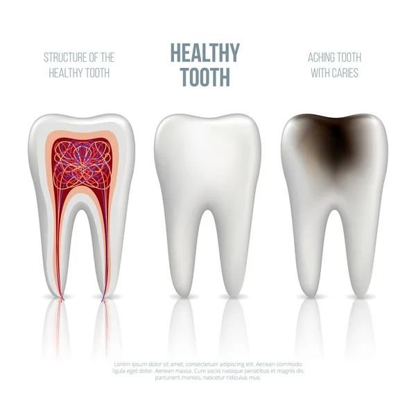 Conjunto de dientes realistas — Vector de stock