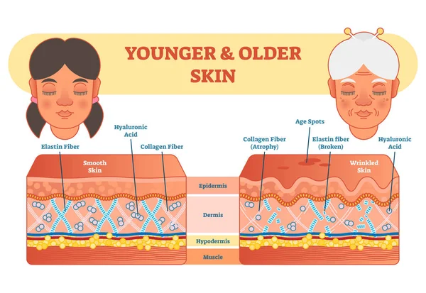 Diagrama de comparação de pele mais velho e mais jovem, esquema de ilustração vetorial . —  Vetores de Stock