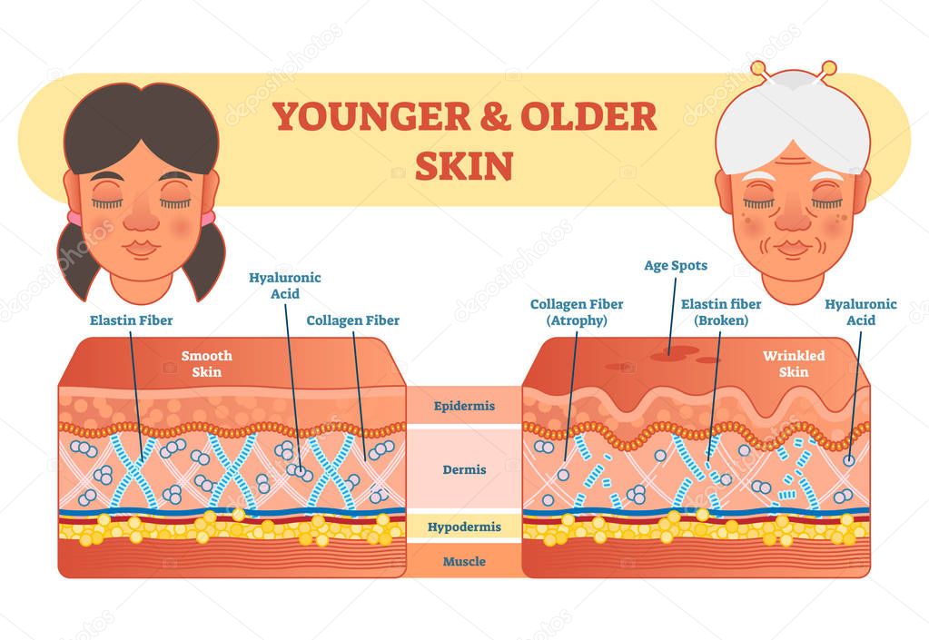 Older and younger skin comparison diagram, vector illustration scheme