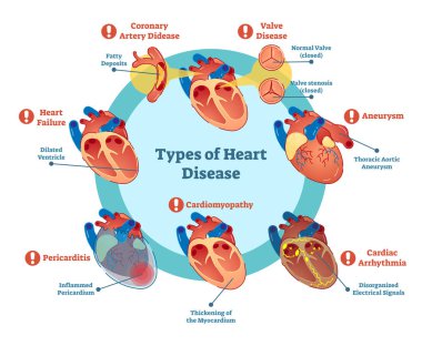 Types of heart disease collection, vector illustration diagram clipart
