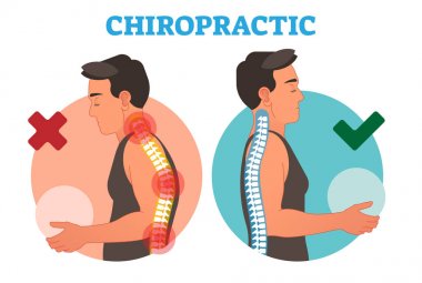 Chiropractic kavramsal vektör çizim arka kemik eğriliği ile. 