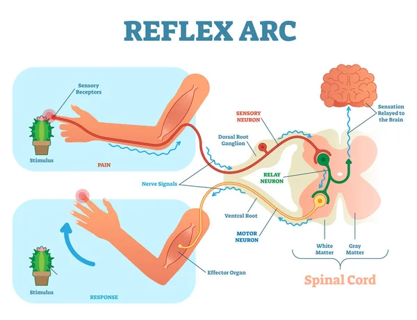 Esquema anatómico del arco reflexivo espinal, ilustración vectorial, con médula espinal, vía de estímulo a la neurona sensorial, neurona de retransmisión, neurona motora y tejido muscular . — Vector de stock