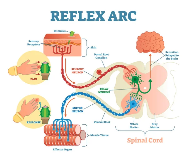 Spinal Reflex Skema anatomi busur, ilustrasi vektor, dengan sumsum tulang belakang, jalur stimulus ke neuron sensorik, neuron relay, neuron motorik dan jaringan otot . - Stok Vektor