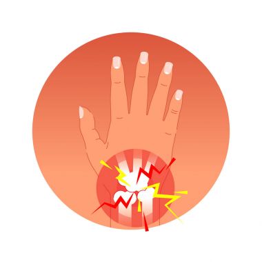 Ağrılı eklem kavramı vektör çizim insan palmiye ve kemik ile. Grafik sembolü ağrı daireler. 