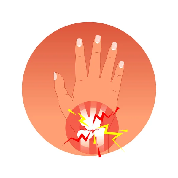 Ilustración dolorosa del vector del concepto de la articulación con la palma humana y huesos. Círculos de dolor símbolo gráfico . — Archivo Imágenes Vectoriales