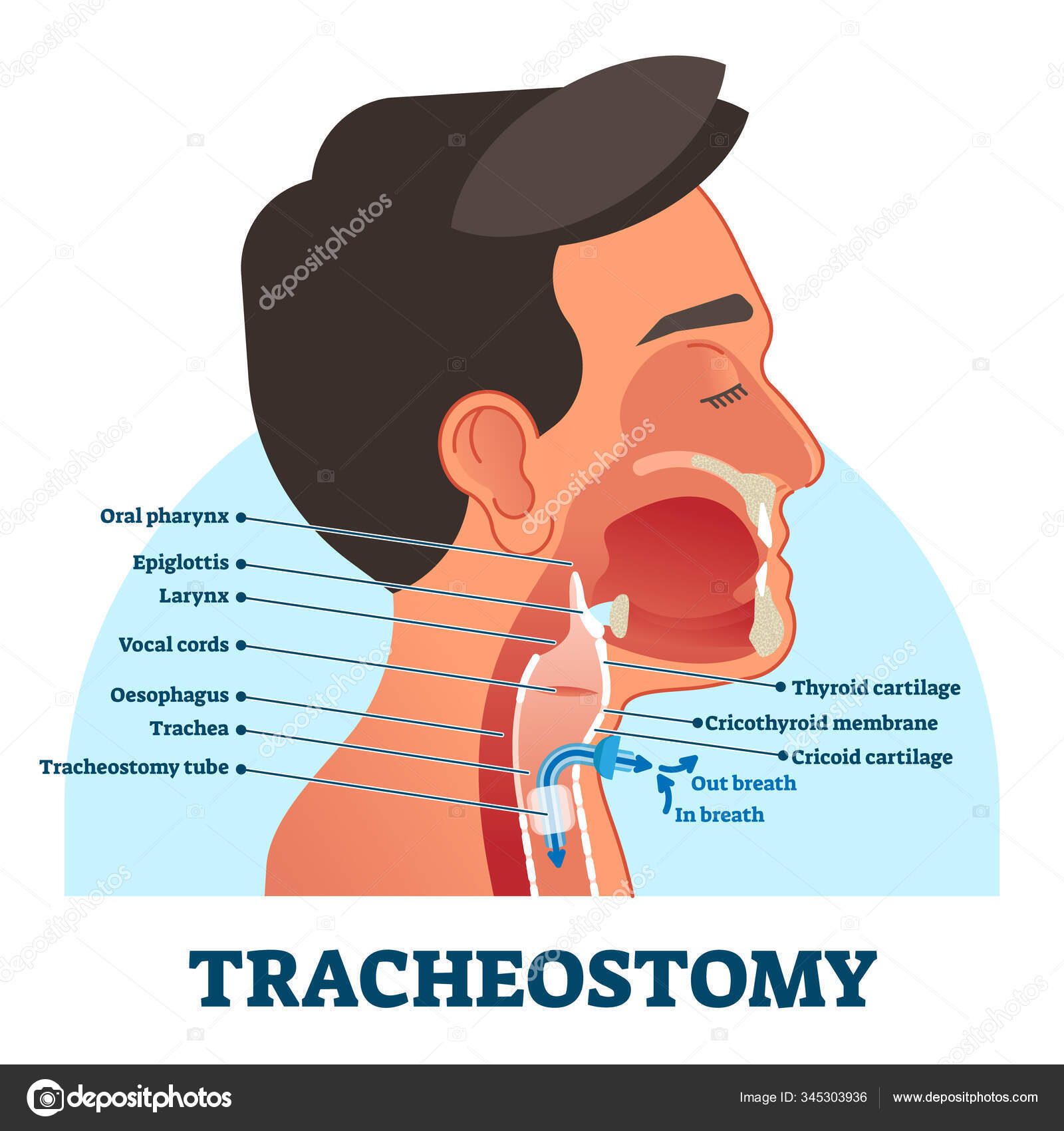Tracheostomy cross section diagram, vector illustration Stock Vector Image  by ©VectorMine #345303936