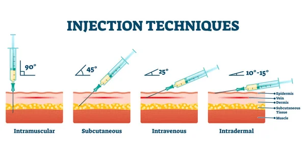 Injectietechnieken vector illustratie. Voorbeelden medische procedure — Stockvector