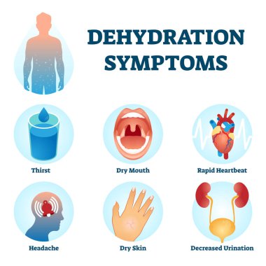Dehydration symptoms vector illustration. Water deficit diagnosis scheme. clipart