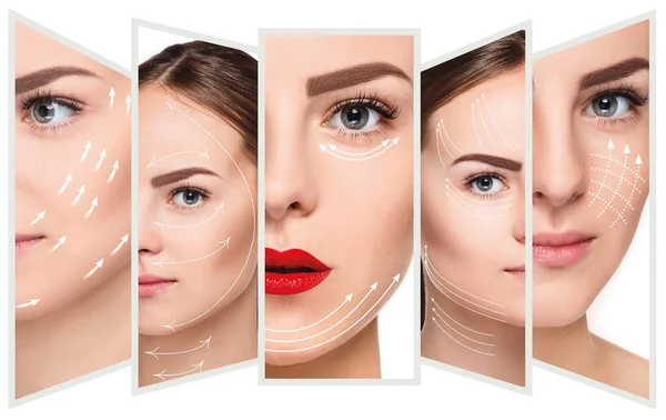 El rostro femenino joven. Antiaging y el concepto de elevación de hilo — Foto de Stock