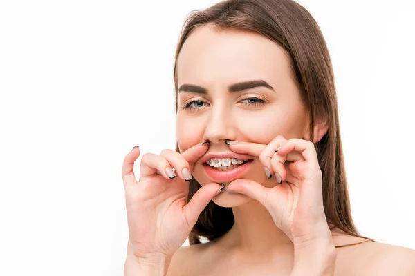 Schöne junge Frau mit Zahnspange — Stockfoto