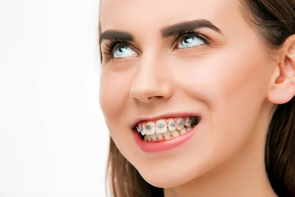Piękna młoda kobieta z szelkami zębów — Zdjęcie stockowe