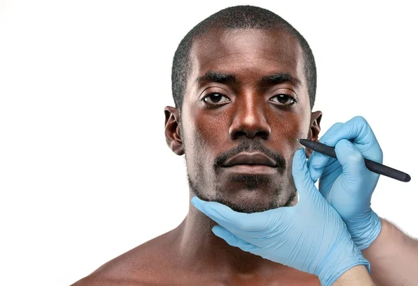 外科医は、灰色の背景の男性の顔のマークを描きます。整形外科のコンセプト — ストック写真