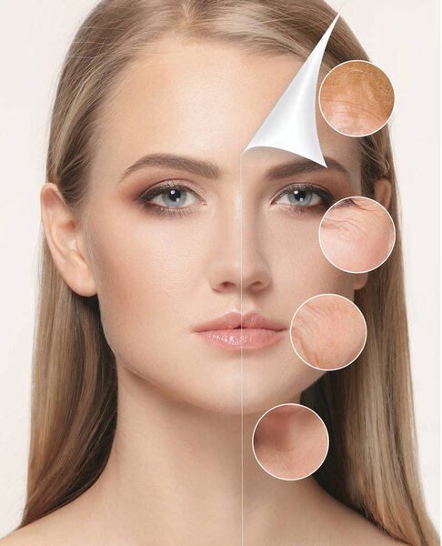 portrait of beautiful woman with problem and clean skin, aging and youth concept, beauty treatment