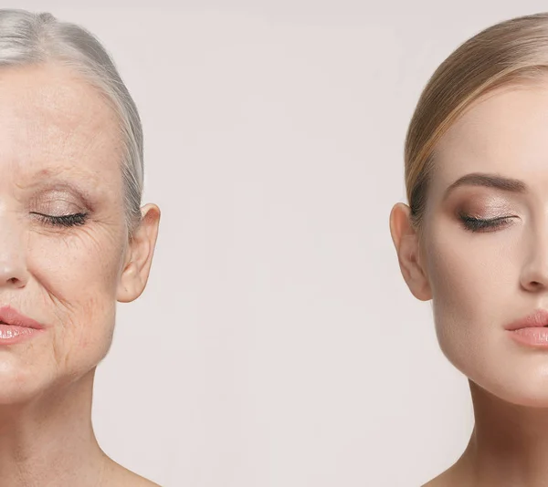 Comparison. Portrait of beautiful woman with problem and clean skin, aging and youth concept, beauty treatment Stock Picture