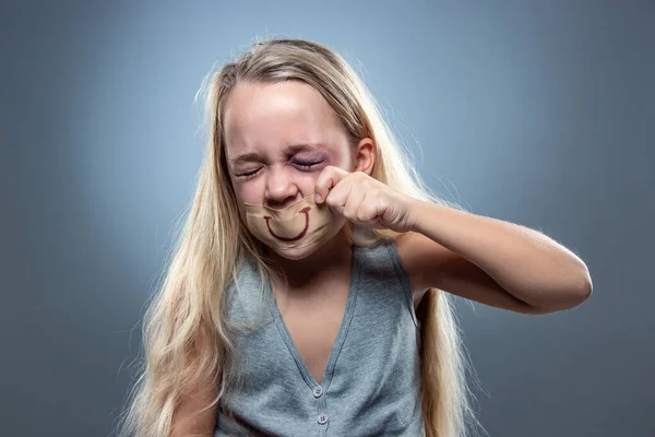 Sad and frightened little girl with bloodshot and bruised eyes, fiction of happiness — Stock Photo, Image