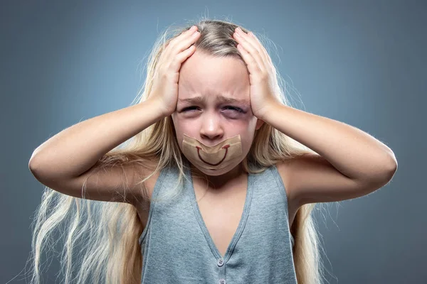 Triest en bang klein meisje met bloeddoorlopen en gekneusde ogen, fictie van geluk — Stockfoto