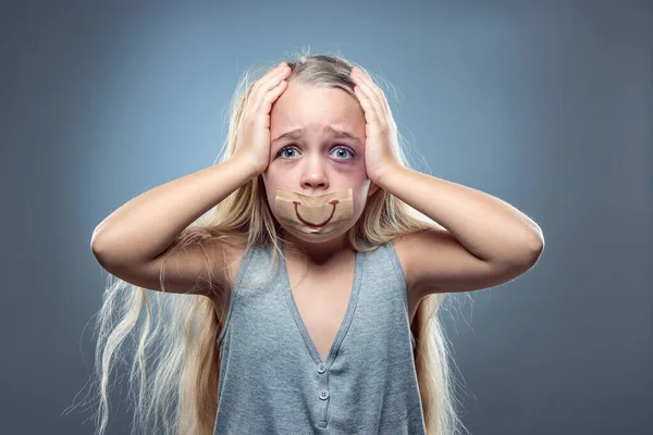 Niña triste y asustada con sangre y ojos magullados, ficción de felicidad — Foto de Stock