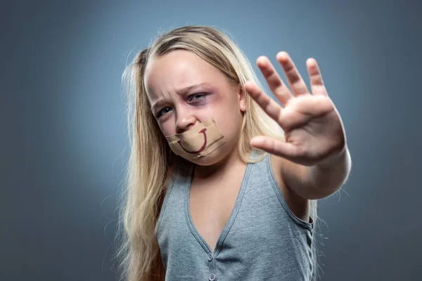 Menina triste e assustada com sangue e olhos machucados, ficção de felicidade — Fotografia de Stock