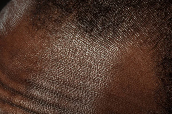Textura de piel humana. Acercamiento del cuerpo masculino afroamericano — Foto de Stock
