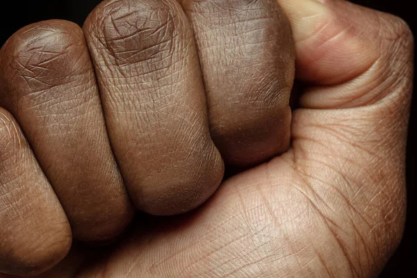 Textura da pele humana. Close up do corpo masculino afro-americano — Fotografia de Stock