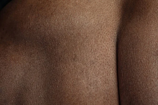 Texture of human skin. Close up of african-american male body — Stock Photo, Image