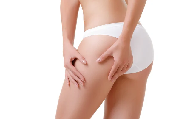 Checking cellulite woman hip close up — Stock Photo, Image