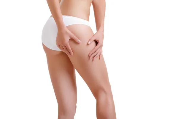 Checking cellulite woman hip close up — Φωτογραφία Αρχείου