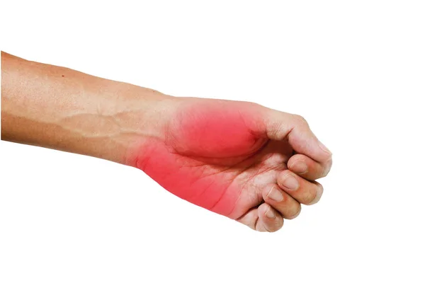 Inflamação muscular na mão, Inflamação muscular na mão de trás — Fotografia de Stock