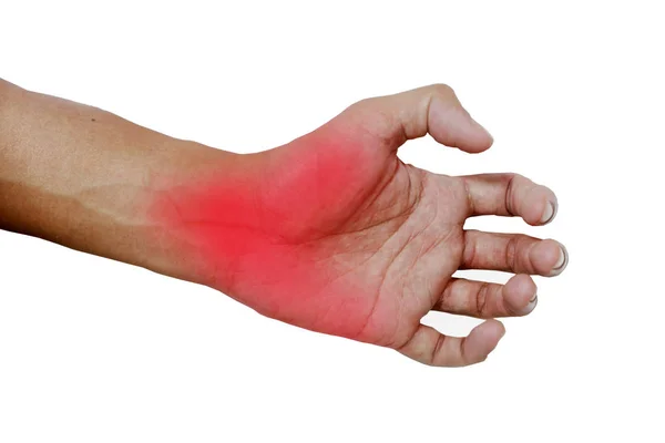 Inflamação muscular na mão, Inflamação muscular na mão de trás Imagens De Bancos De Imagens