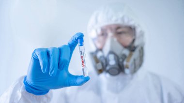 Biyolojik tehlike kimyevi koruyucu giysi (PPE) giyen tıp bilimadamı, hastane laboratuvarında COVID-19 deney tüpü tutan maske ve gözlükler. Erkek doktor ya da doktor Coronavirus vakasının sonucunu alıyor.