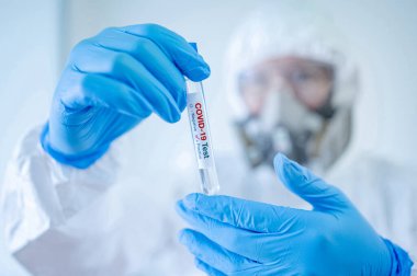 Biyolojik tehlike kimyevi koruyucu giysi (PPE) giyen tıp bilimadamı, hastane laboratuvarında COVID-19 deney tüpü tutan maske ve gözlükler. Erkek doktor ya da doktor Coronavirus vakasının sonucunu alıyor.