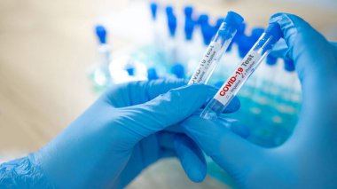 Hastane laboratuarında COVID-19 test tüpü tutan mavi steril lastik eldivenli tıp bilimci eli. Erkek doktor ya da doktor Coronavirus vakasının sonucunu alıyor. 2019-nCoV laboratuvar test konsepti